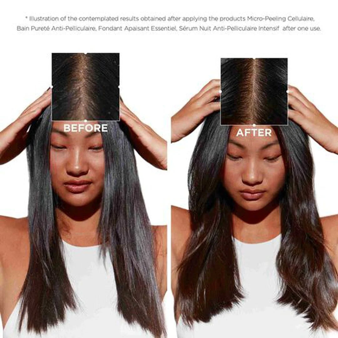 Kerastase Symbiose Pureté Anti-Dandruff Shampoo for Oily Scalp
