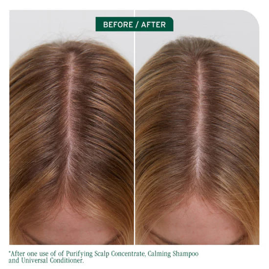 Biolage Scalp Sync Universal Conditioner - 236ml