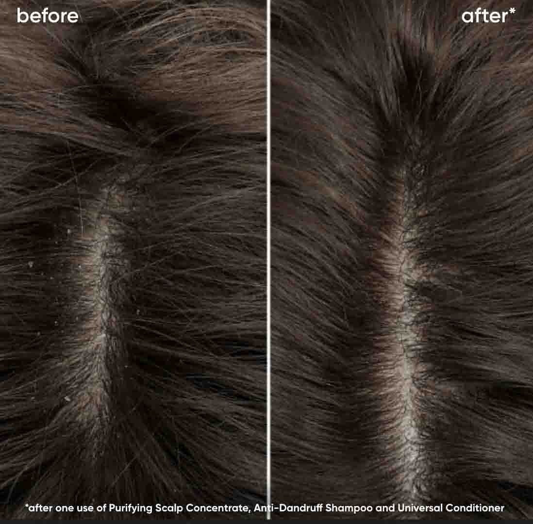 Biolage Purifying Scalp Concentrate